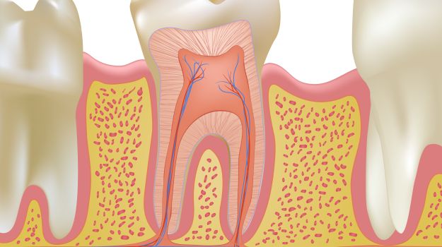 dentalroottipinfectionincreasesheartdiseaserisk